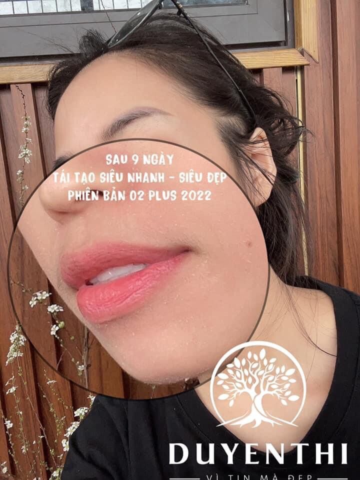 Combo cho da mụn Bách y sâm - bạch linh (tặng 1 hộp ngâm chân Bách thọ khang 195k)