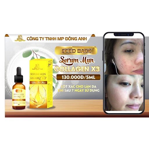 Serum mụn collagen x3 chính hãng 100%