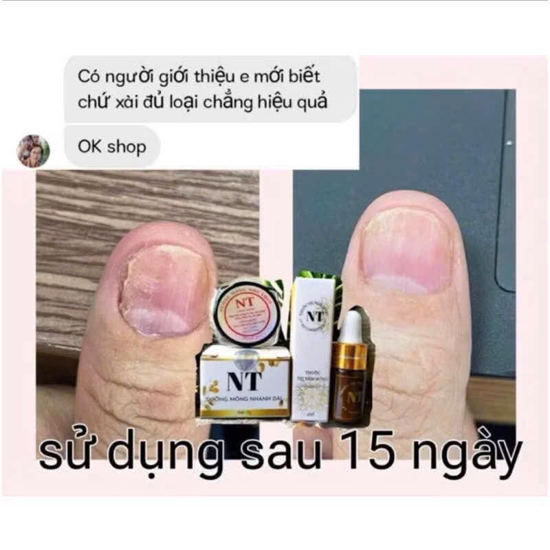 COM BO TRỊ NẤM MÓNG DƯỠNG MÓNG NT (chính hãng)