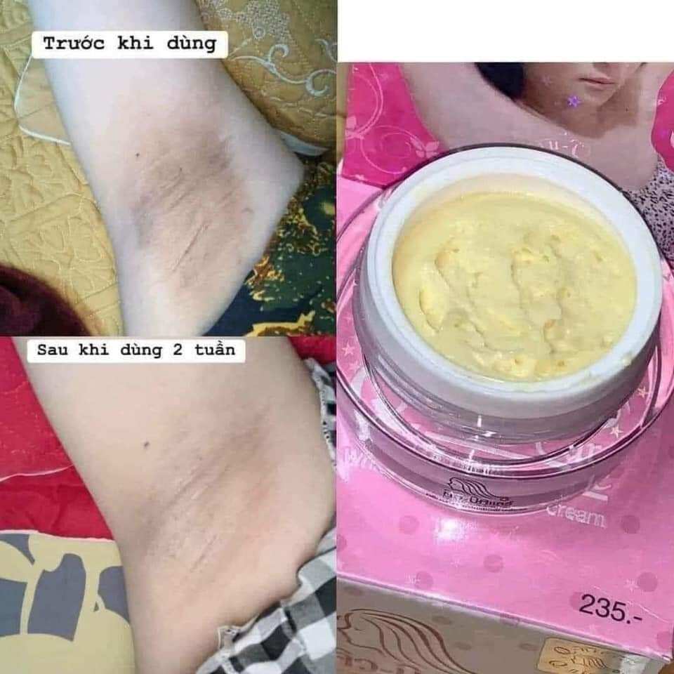 Kem dưỡng da giam thâm nách q - nic thái lan