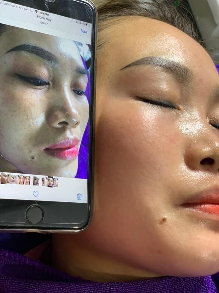 osakura số 2 thuỷ kim luverio