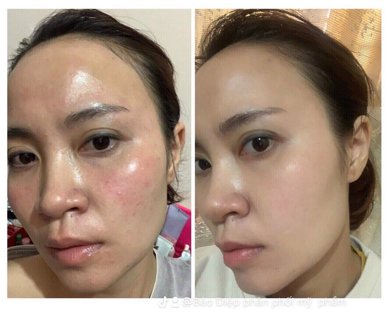 Serum siêu vitamin C