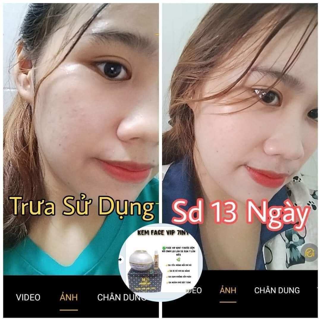 Kem face vip 7in1 Huỳnh Đỗ