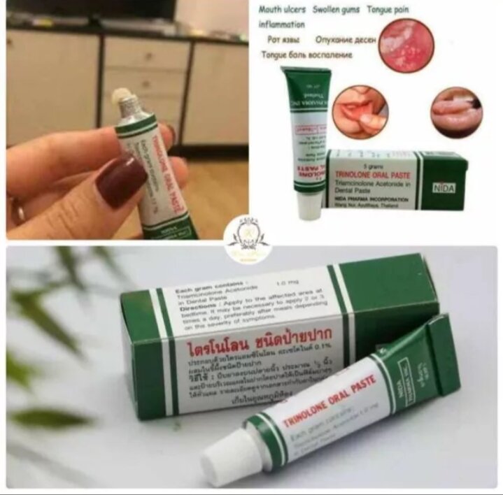 Kem bôi nhiệt miệng Trinolone Thái Lan