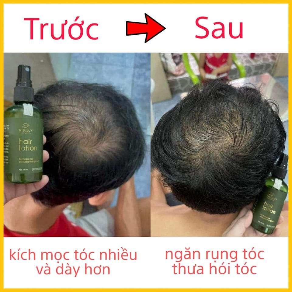 (Mẫu mới) Xịt tóc tinh dầu bưởi vijully. kích thích mọc tóc, giảm rụng tóc