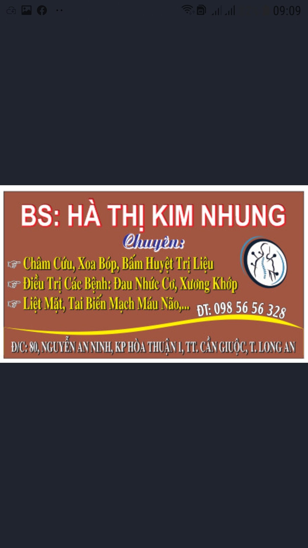 BI LĂN TẬP TAY BẰNG INOX