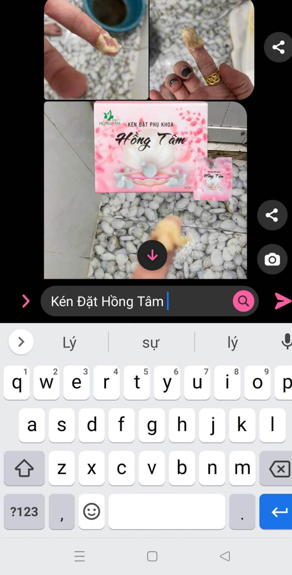 combo kén đặt phụ khoa sạch khít hồng