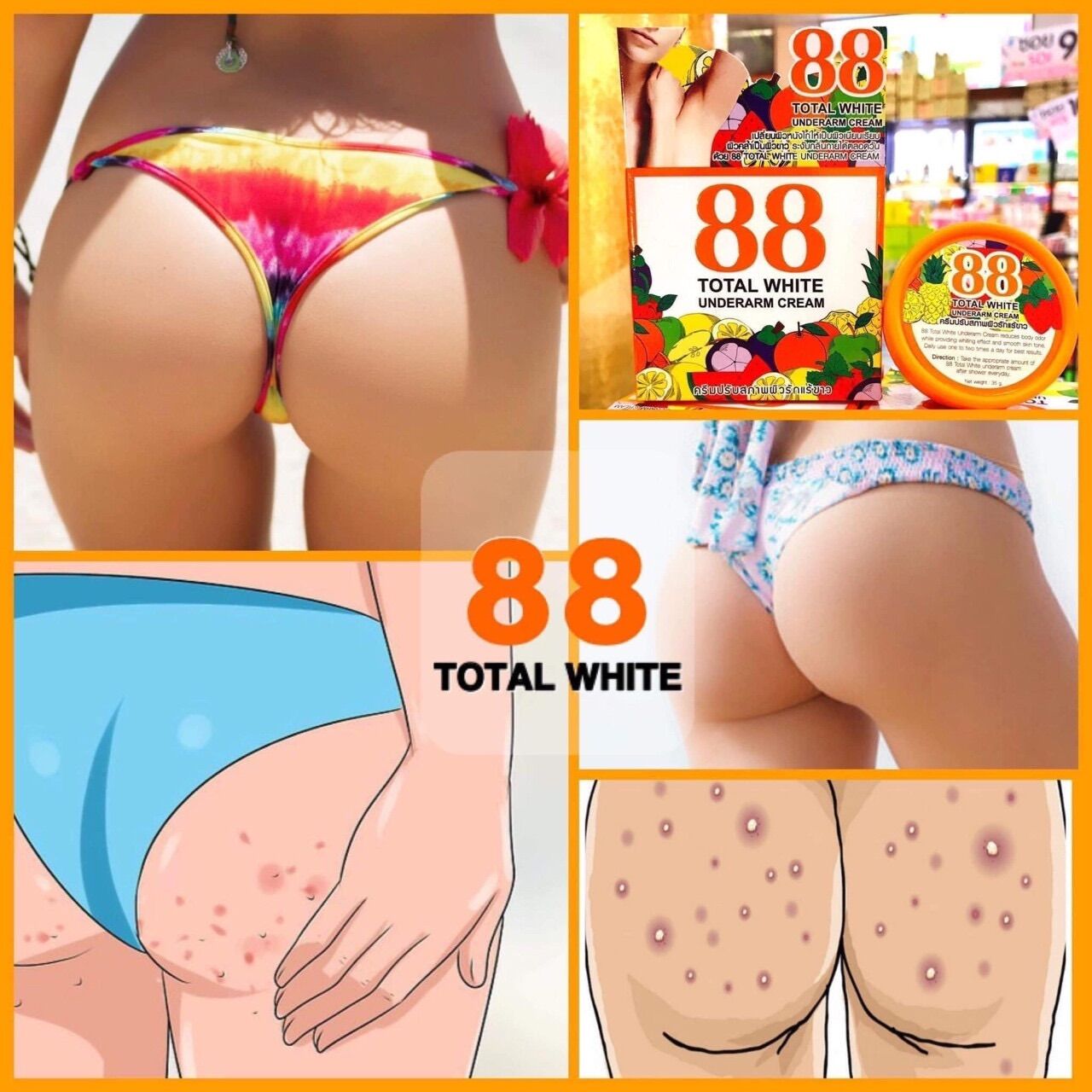 Kem giảm thâm 88 nách, háng, bẹn bikini thái lan
