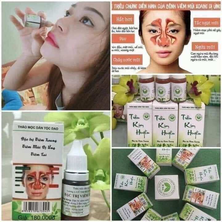 viêm xoang trần Kim huyền