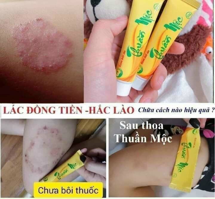 thuần mộc. < kem bôi da >