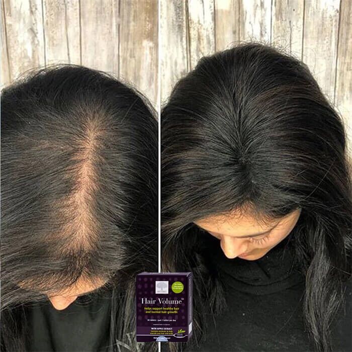 New Nordic Hair Volume Viên Uống Kích Thích Mọc Tóc 30 tablets - Gardencos