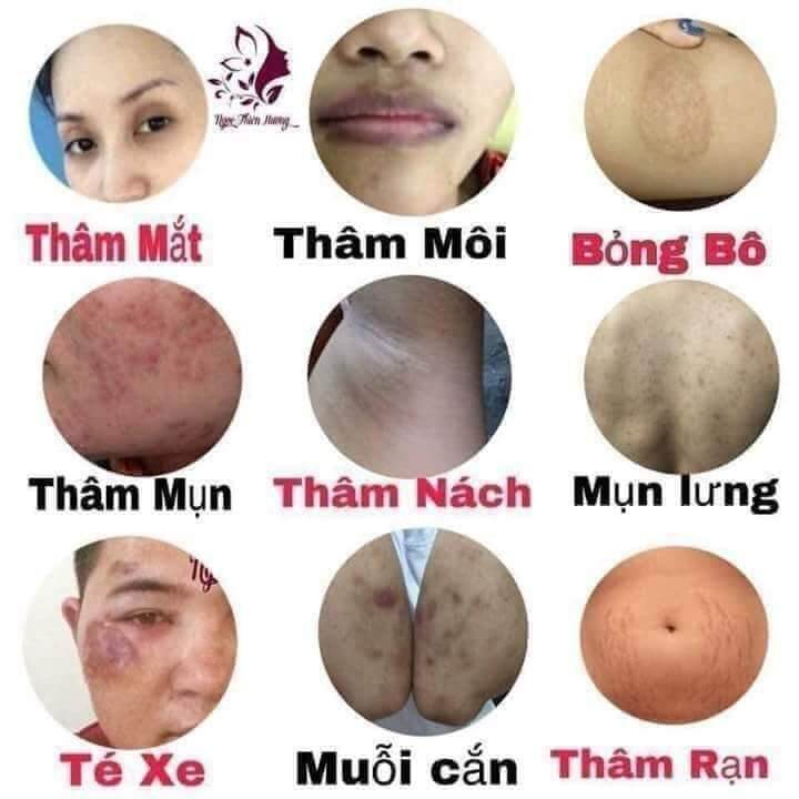 Tinh Dầu Cao Cấp Xoá Thâm Linh Hương