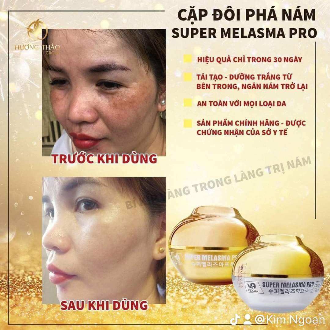 BỘ ĐÔI PHÁ NÁM ĐỈNH CAO SUPER MELASMA PRO
