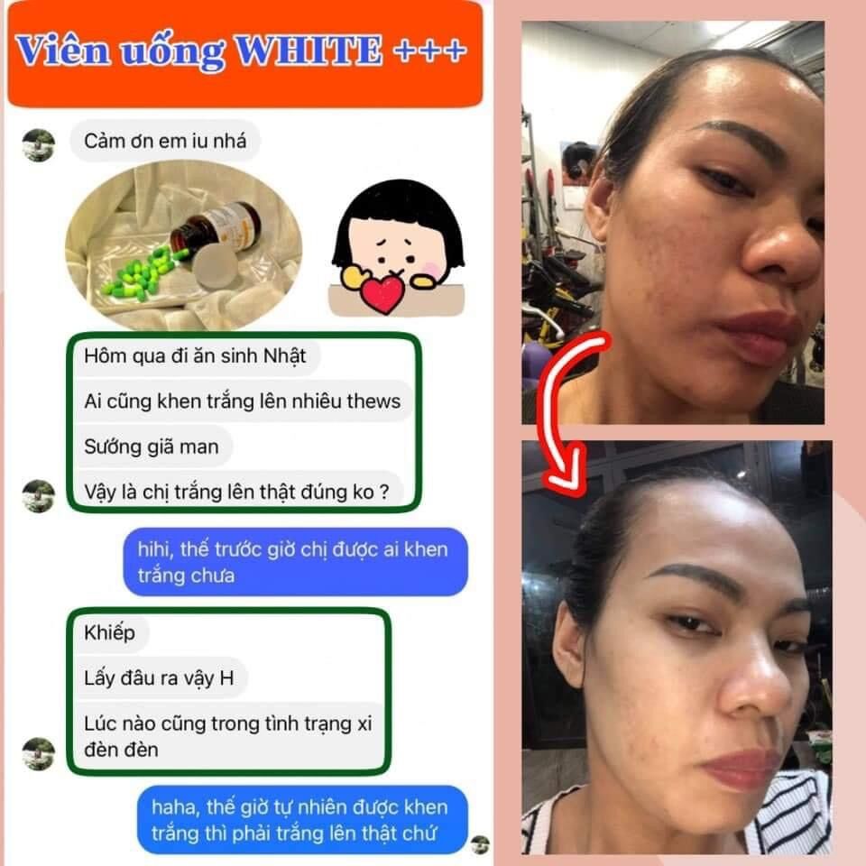 (Combo) Mờ NÁM CAO CẤP HUNA 1 L.TRÌNH HUNA