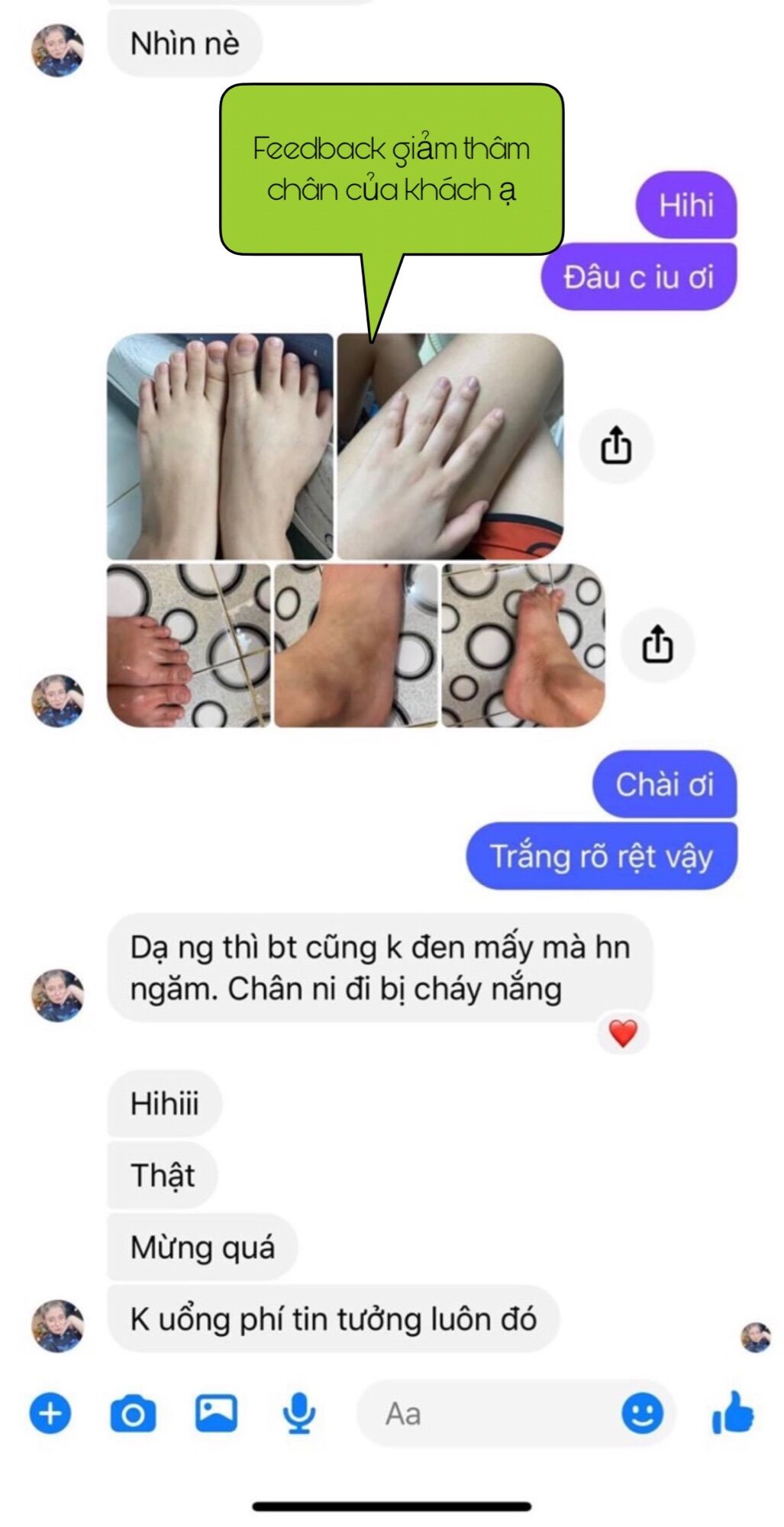 [ CAM KẾT BẬT TONE SAU 1H ] KEM DƯỠNG TRẮNG DA BODY KHÔNG BÀO MÒN DA
