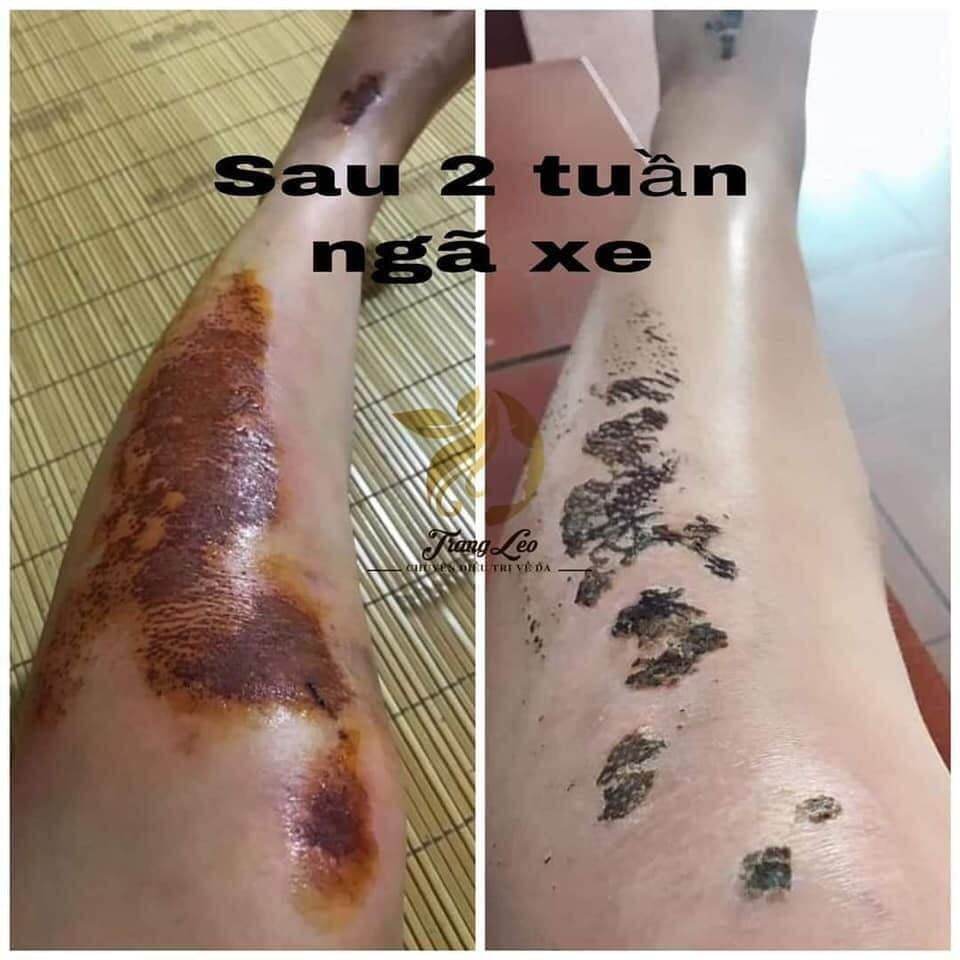 SIÊU PHỤC HỒI DA HƯ TỔN - KAMEL SERUM K+ SUPER RECOVERY