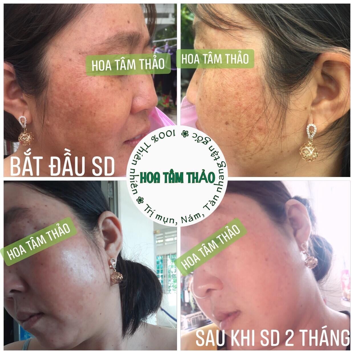 Combo thảo dược Hoa Tâm Thảo 100% thiên nhiên