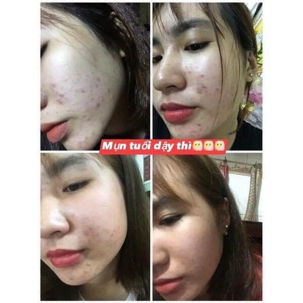 Kem Dữơng Trắng Sáng Da Face Queen Mini