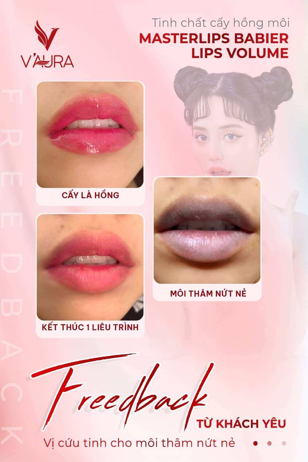 SERUM CẤY MÀU MÔI VAURA V3 (mẫu mới)