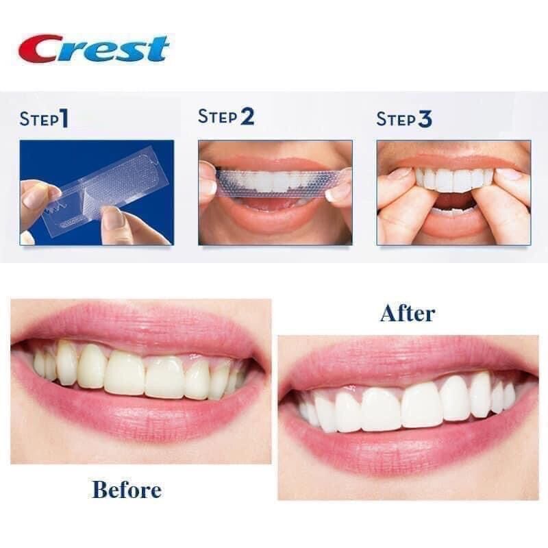 Combo 7 ngày dán trắng răng Crest Supreme Bright