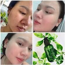 [HCM]Thay da nhân sâm mqskin