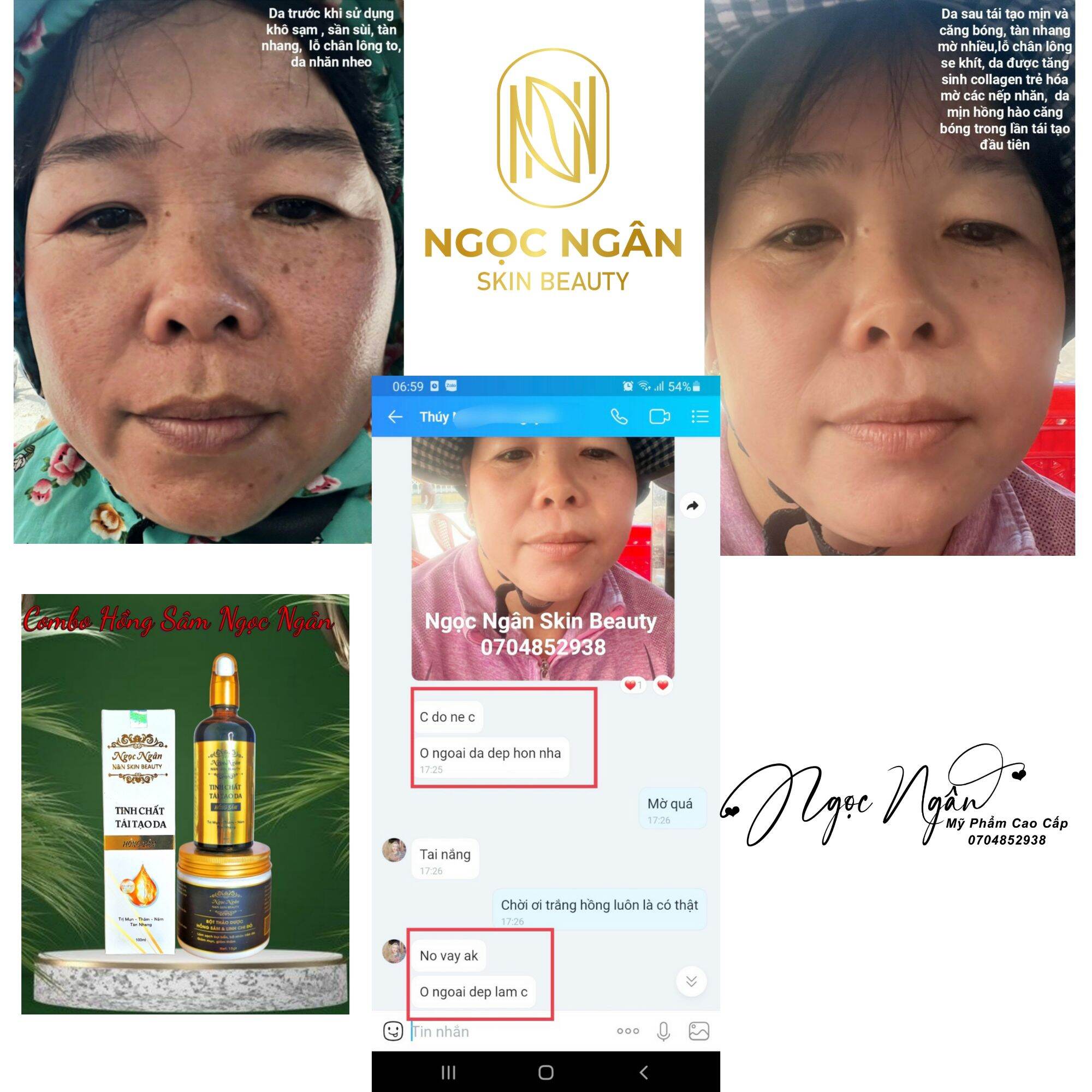 TÁI TẠO HỒNG SÂM