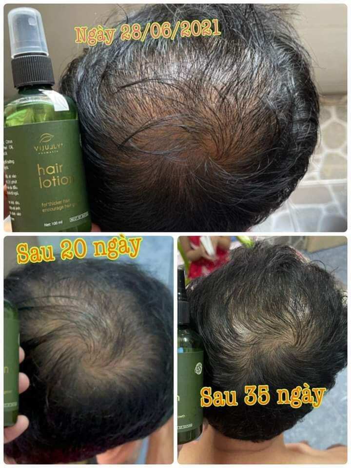 (Mẫu mới) Xịt tóc tinh dầu bưởi vijully. kích thích mọc tóc, giảm rụng tóc