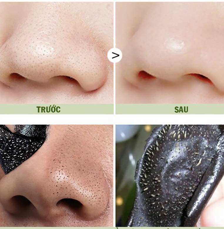 LỘT MỤN THAN TRE RONG BIỂN DR CELL