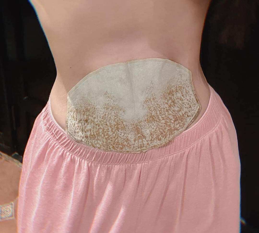 Miếng Dán Tan Mỡ Bụng Cao Linh Chi FITPLUS+ Slim Patch