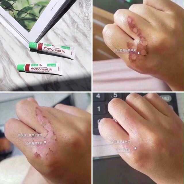Kem bôi sẹo thâm mụn Gentacin Nhật bản cam kết sản phẩm đúng mô tả chất lượng đảm bảo an toàn cho người sử dụng