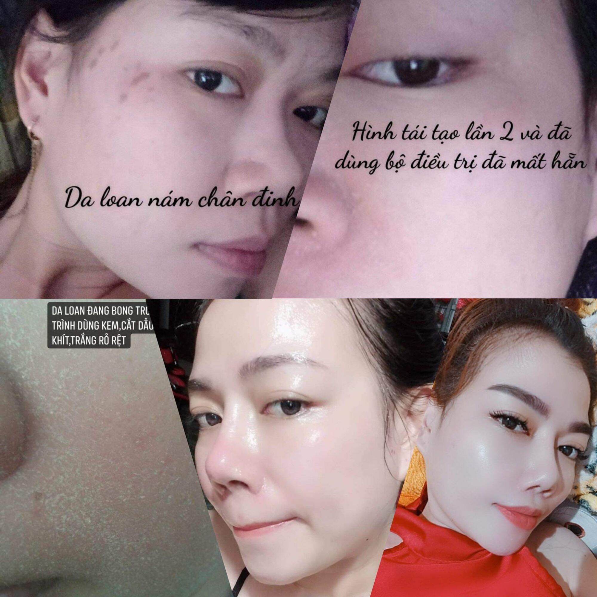 kem face bong da