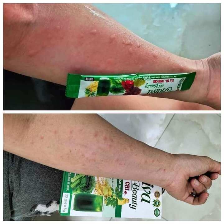 Combo 3 Hộp Thải Độc Adiva Beauty G24