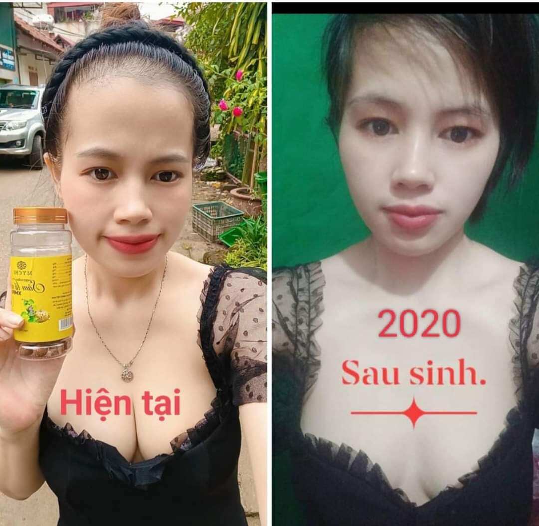 Kẹo mầm sâm tố nữ Xmax Mychi (mua 4 hộp tặng 1 hộp=5 hộp)
