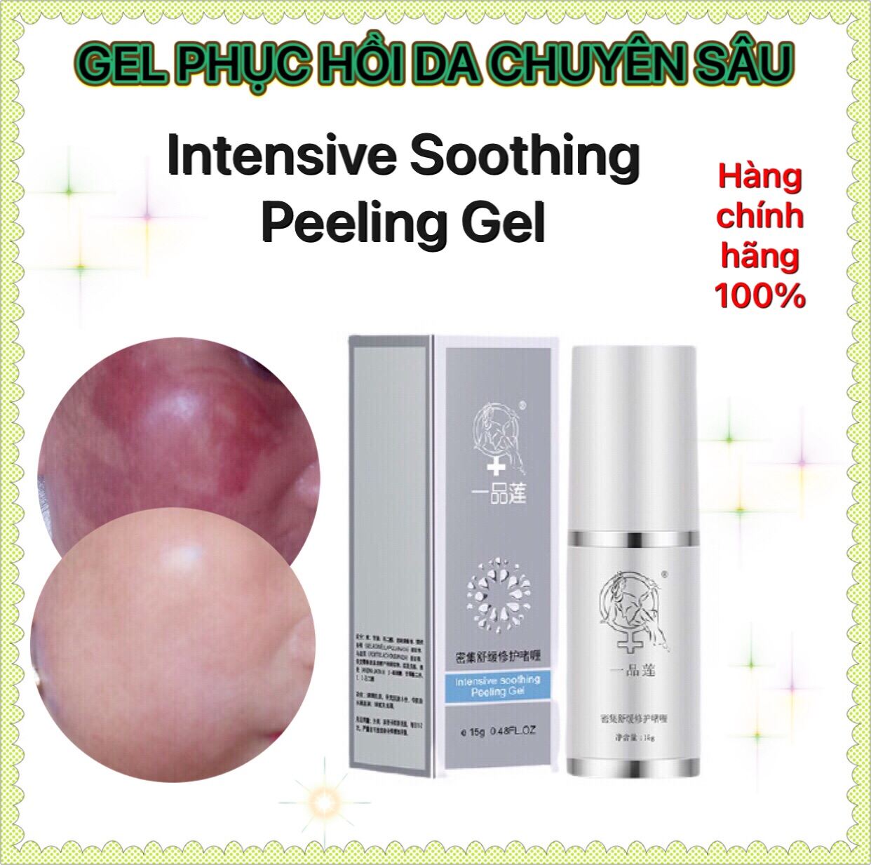 Gel Phục Hồi Da Đỏ Mỏng Yếu Chuyên Sâu Da Bị Tổn Thương Và Làm Dày Da - Intensive Soothing Peeling Gel 15G