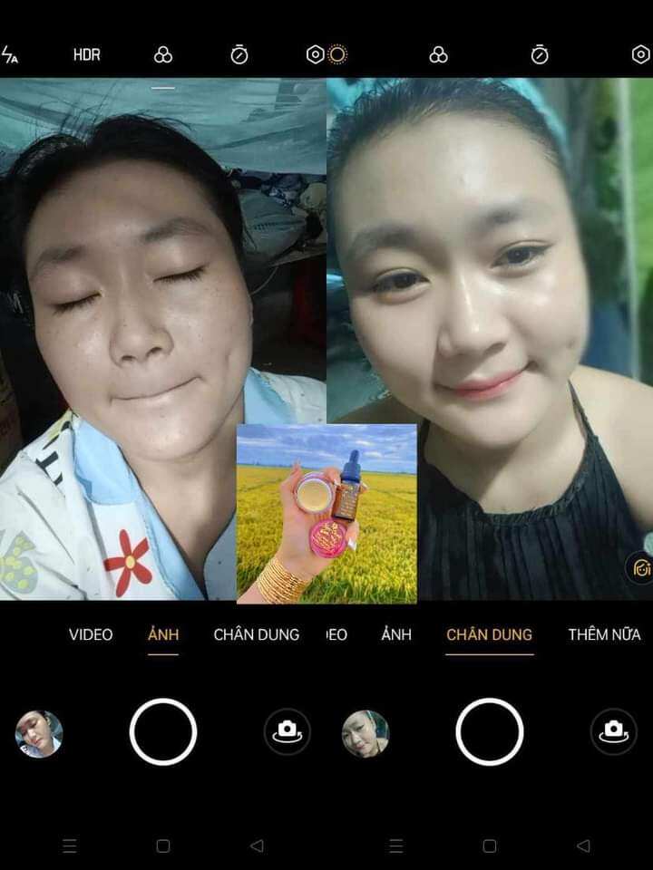 COMBO kem face Ngọc Oanh