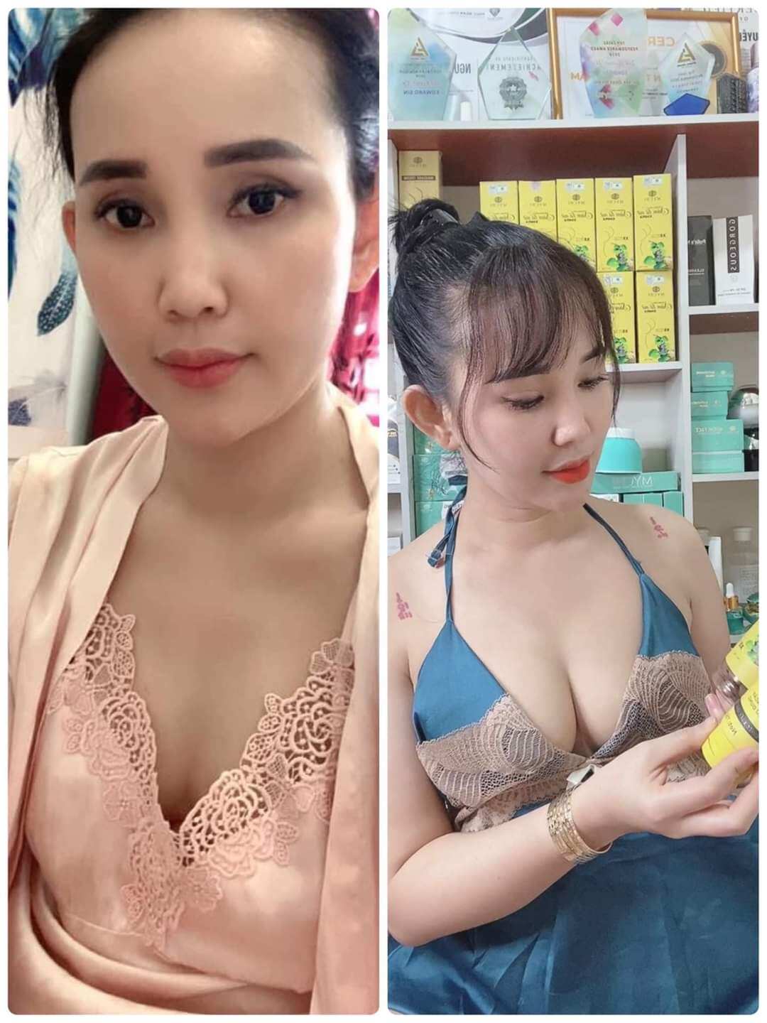 (Khách mua 4 hộp tặng 1 hộp) Kẹo nở ngực, căng tròn,tạo khe,săn chắc....