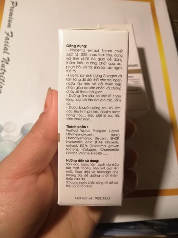 Serum nhau thai cừu mh spa