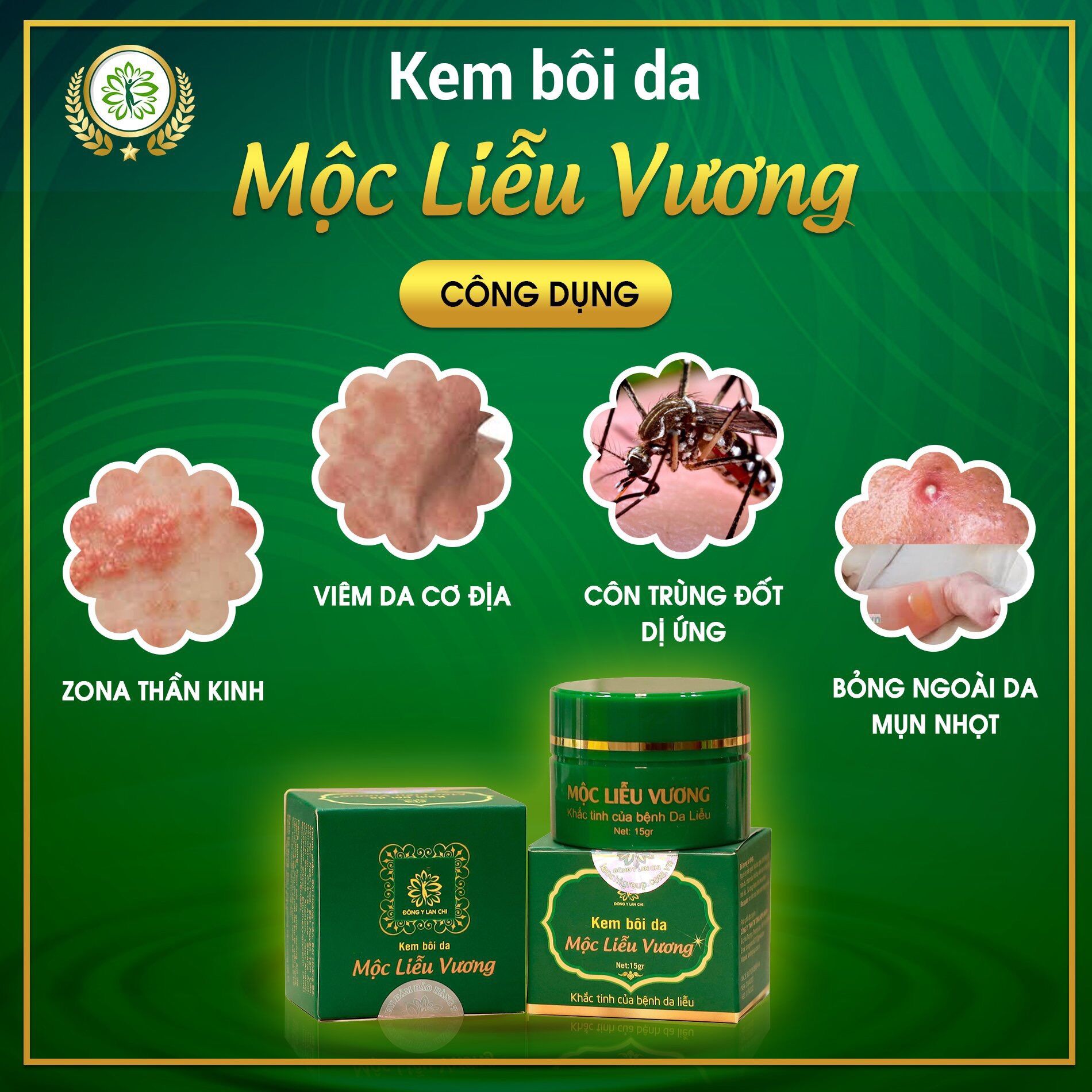 Kem bôi da mộc liễu vương