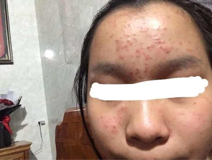 serum khổ qua