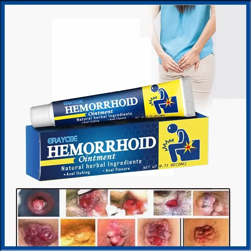 Kem Bôi Trĩ Thảo Dược Trị Trĩ Nội Trĩ Ngoại