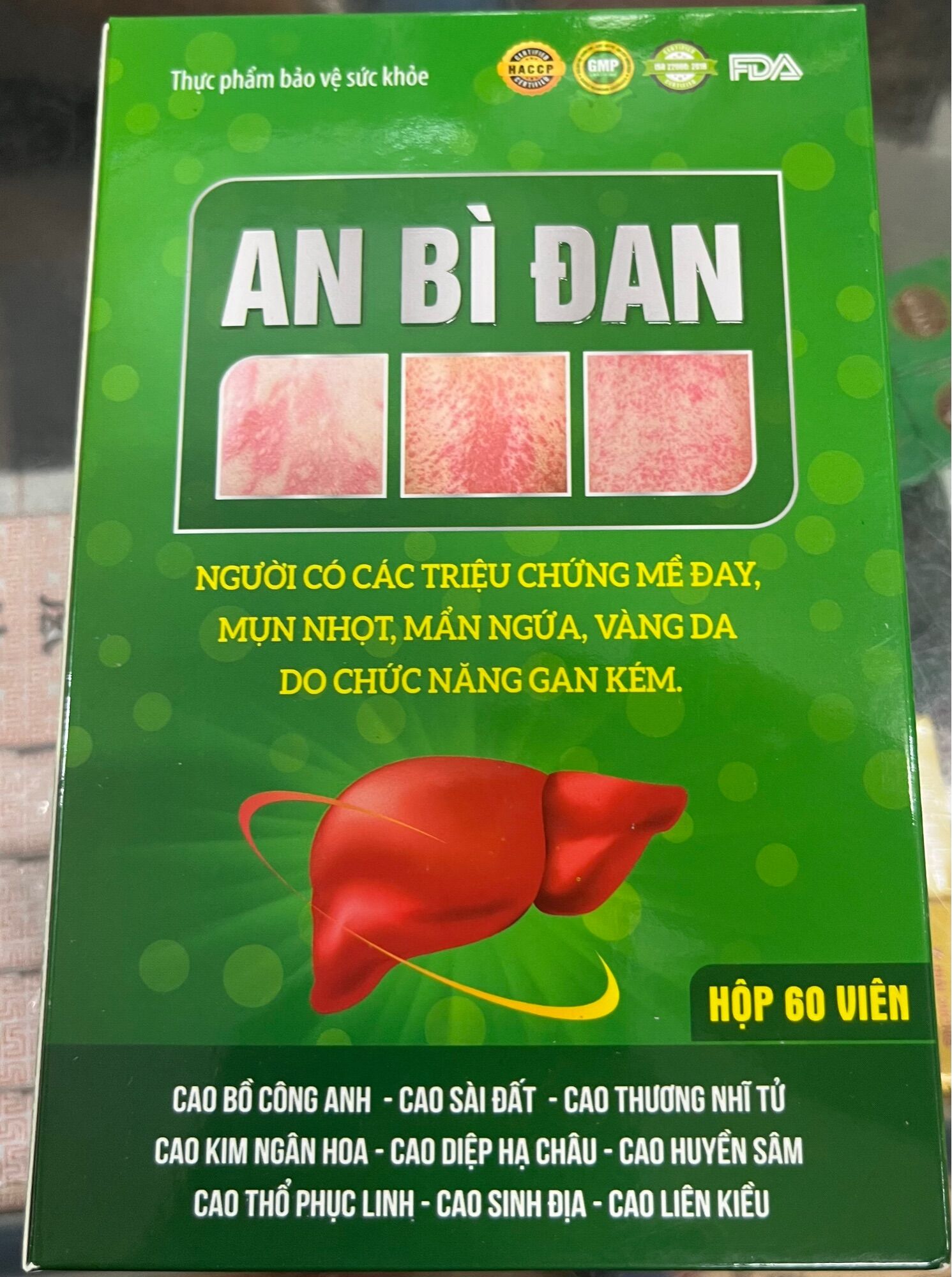 AN BÌ ĐAN DÙNG CHO NGƯỜI MỀ ĐAY MẪN NGỨA