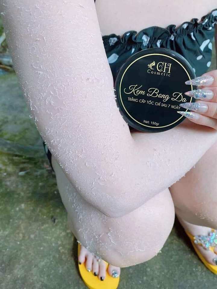 Body Bong Da Trắng Sau 7 Ngày