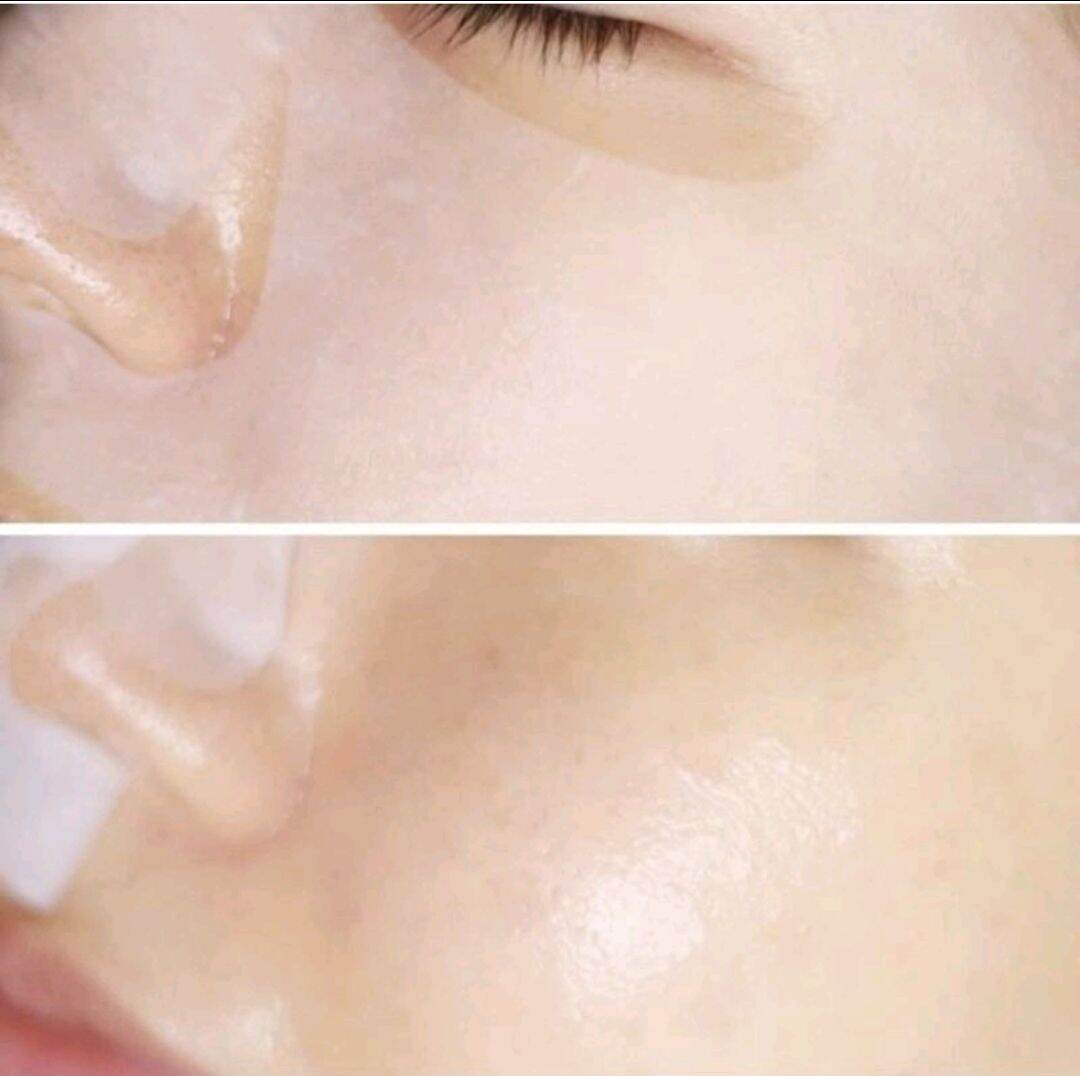 Mặt nạ Mediheal Teetree CARE Solution Essential Mask Rex