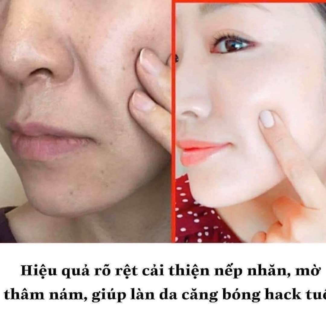 Kem Retinal Lumiderm 1%