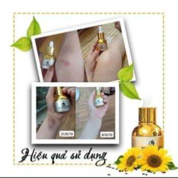 Đặc Trị Thâm Do Côn Trùng Cắn Serum Trị Thâm Đa Năng Phúc Minh Tâm