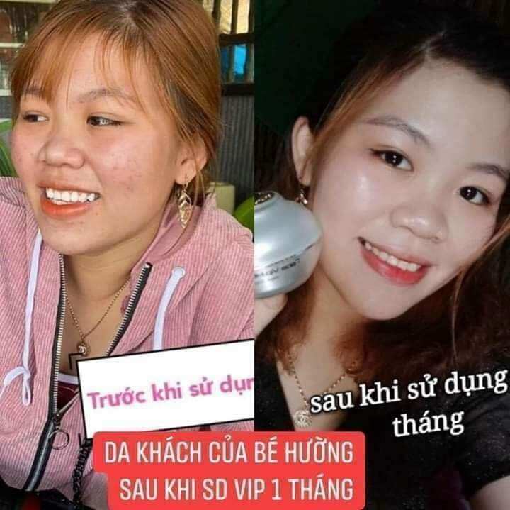 Kem face vip 7in1 Huỳnh Đỗ
