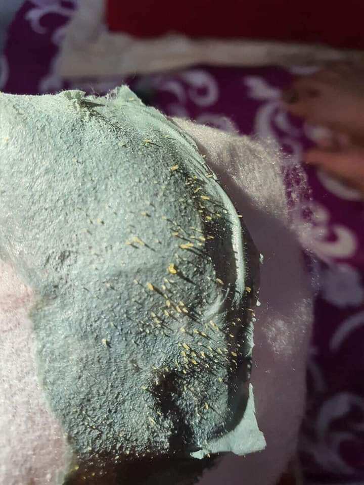 Gel lột mụn acnes chính hãng