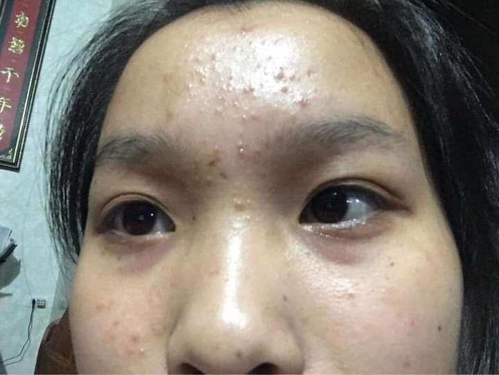 serum khổ qua
