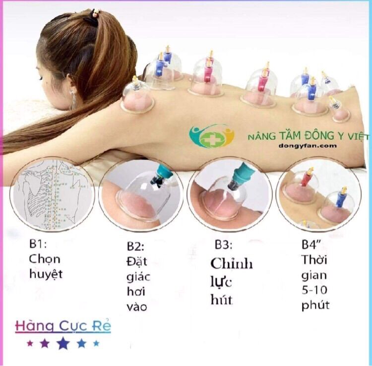 Bộ 12 ống giác hơi chân không không dùng lửa