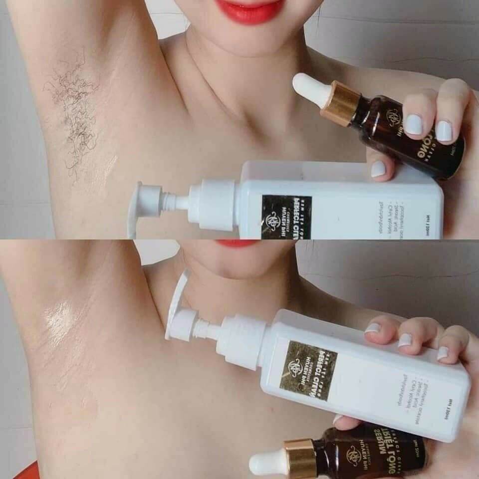 Combo triet long kèm serum Huyền phi c.hang mới